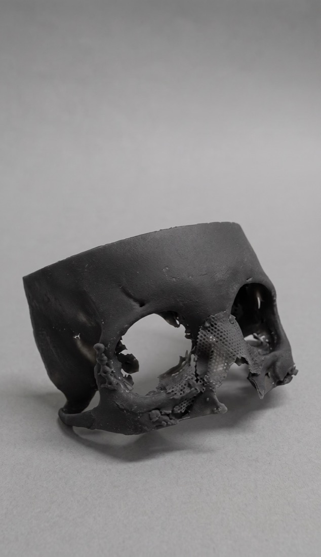 Anatomical skull model