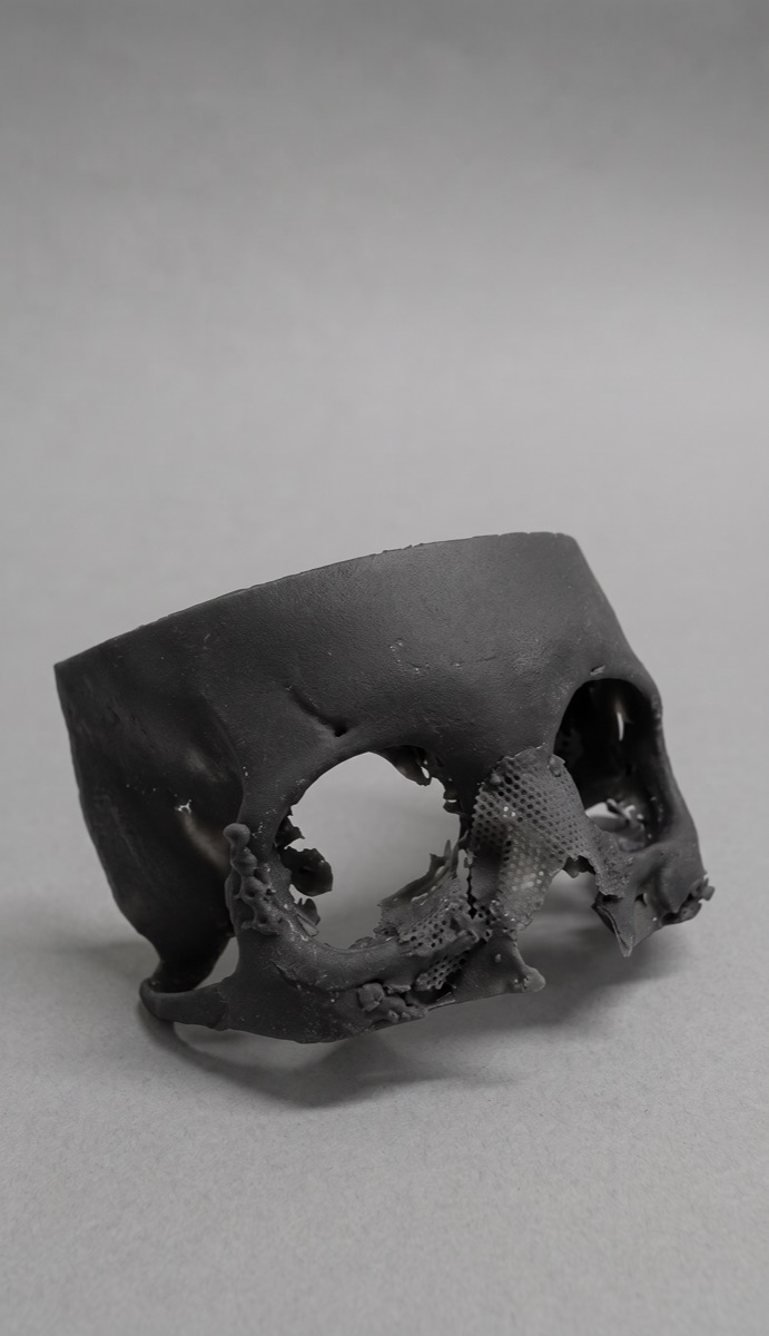 A skull model printed from scan data