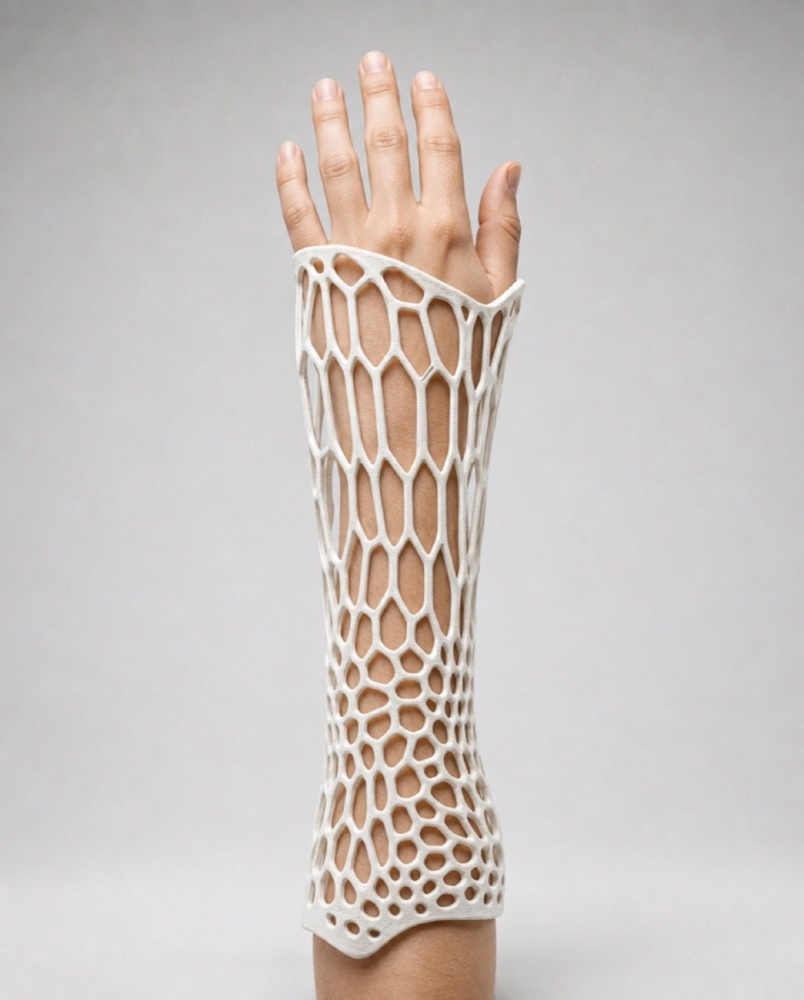 A custom-fit arm cast